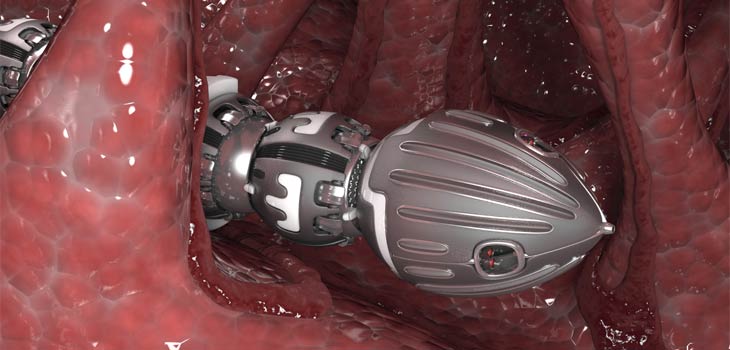 RoboSurgery_730x350